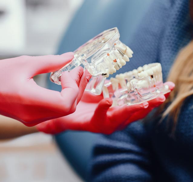 Dental Services in Virginia Beach - Implants